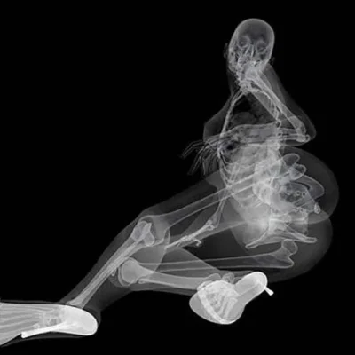 Секс под рентгеном