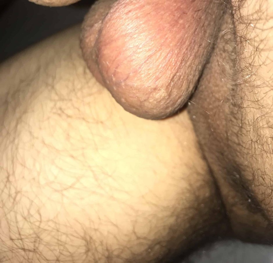 Мужские яички