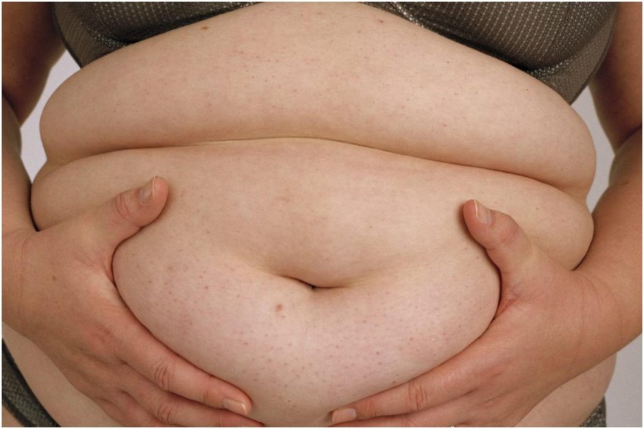 Живот толстый