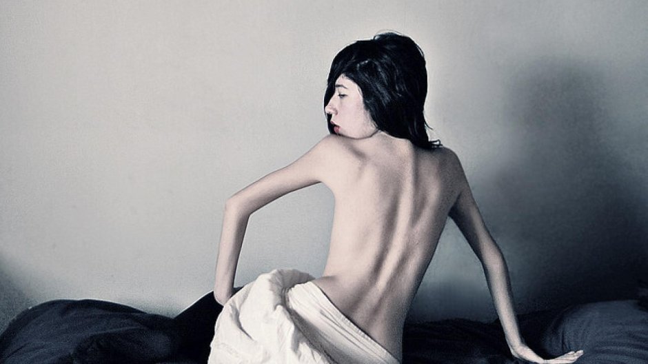 Кахексия и анорексия