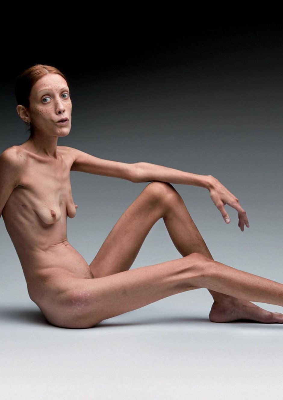 Изабель каро анорексия ню