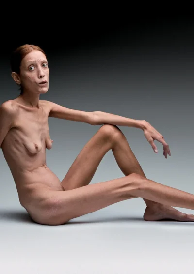 Изабель каро анорексия ню