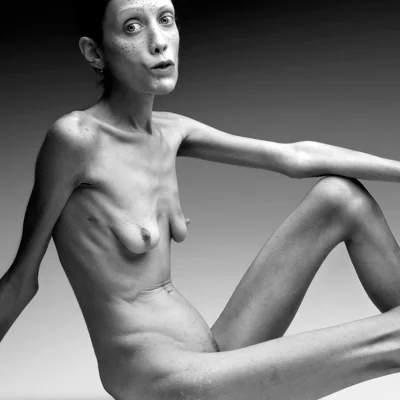 Изабель каро анорексия