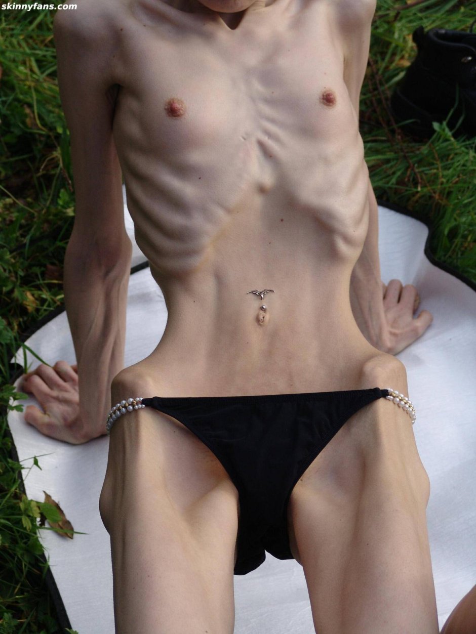 Анорексички фото красивые голые