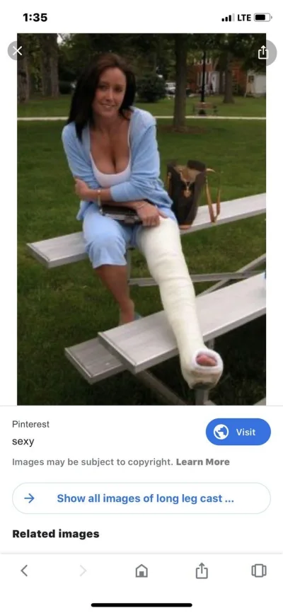 Гипс на ноге