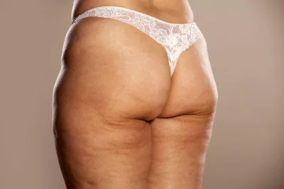 Старые ягодицы