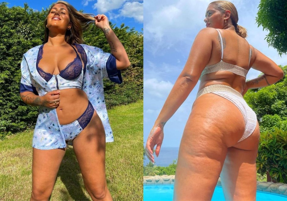 Красивые женщины с целлюлитом