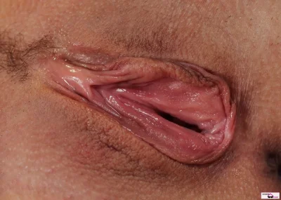 Женская вульва