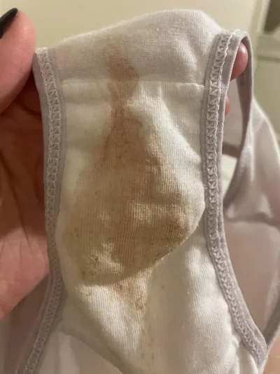 Выделение на трусах