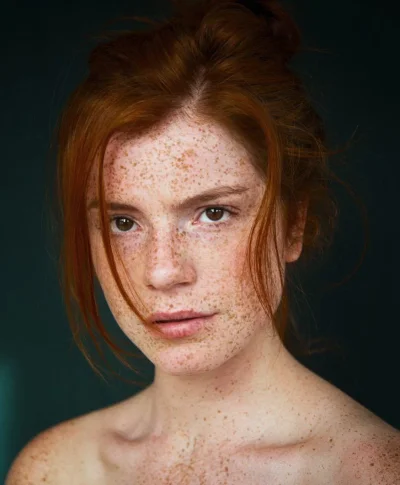 Redhead freckles