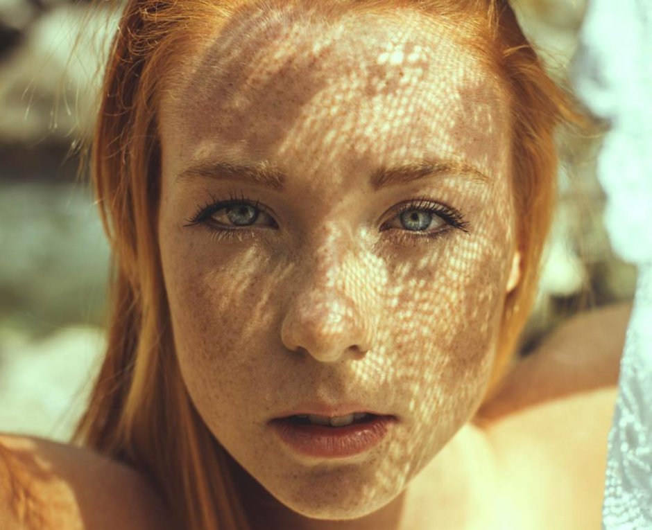 Рыжие веснушки