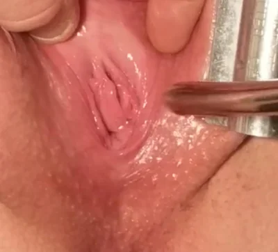 Уретра крупным планом