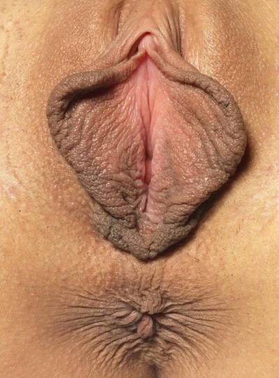 Огромные малые половые губы