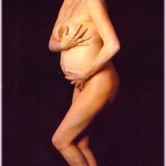 Грудь у беременных