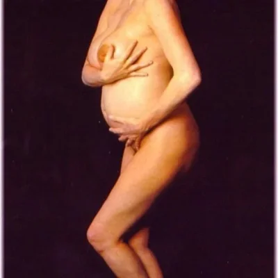 Грудь у беременных