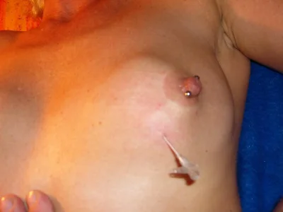 Иголки в сосках