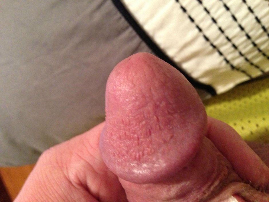 Здоровая головка полового члена