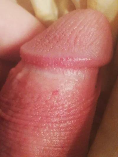 Точки под головкой члена