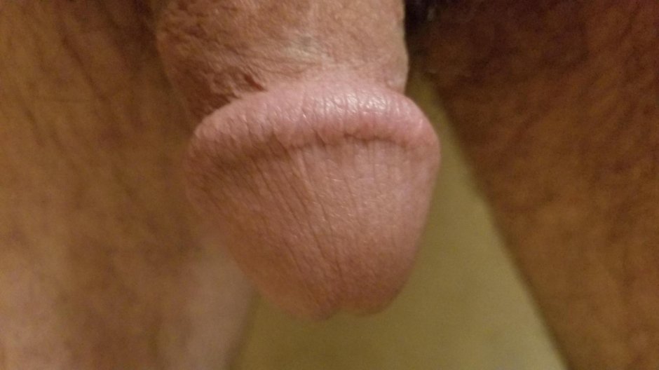 Язык здорового человека