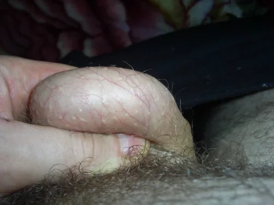 Бугорки на члене