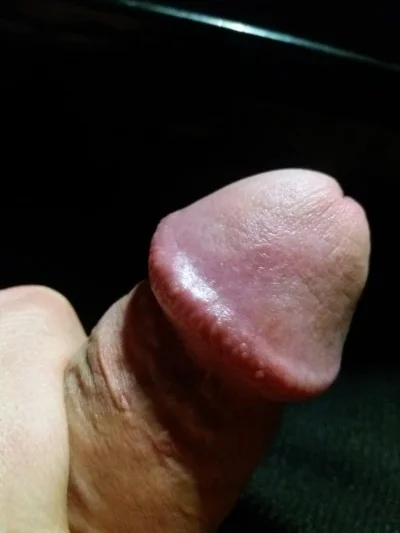 Головка член