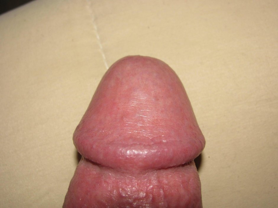 Головка члена крупным планом