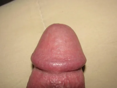 Головка члена крупным планом