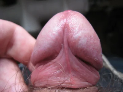 Головка полового органа