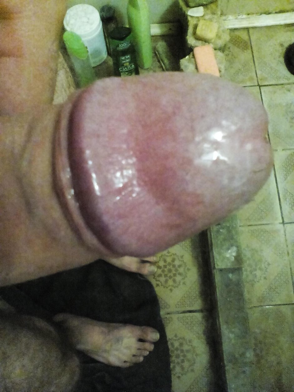 Фиолетовая головка члена