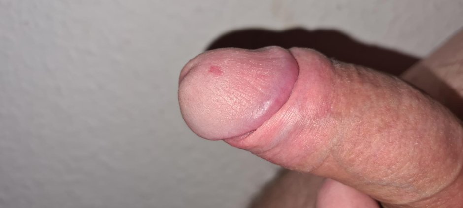 Оголенная головка полового члена