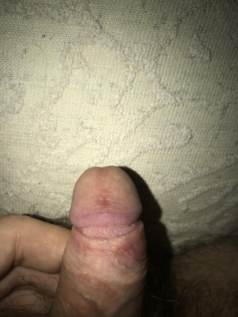 Белая головка члена