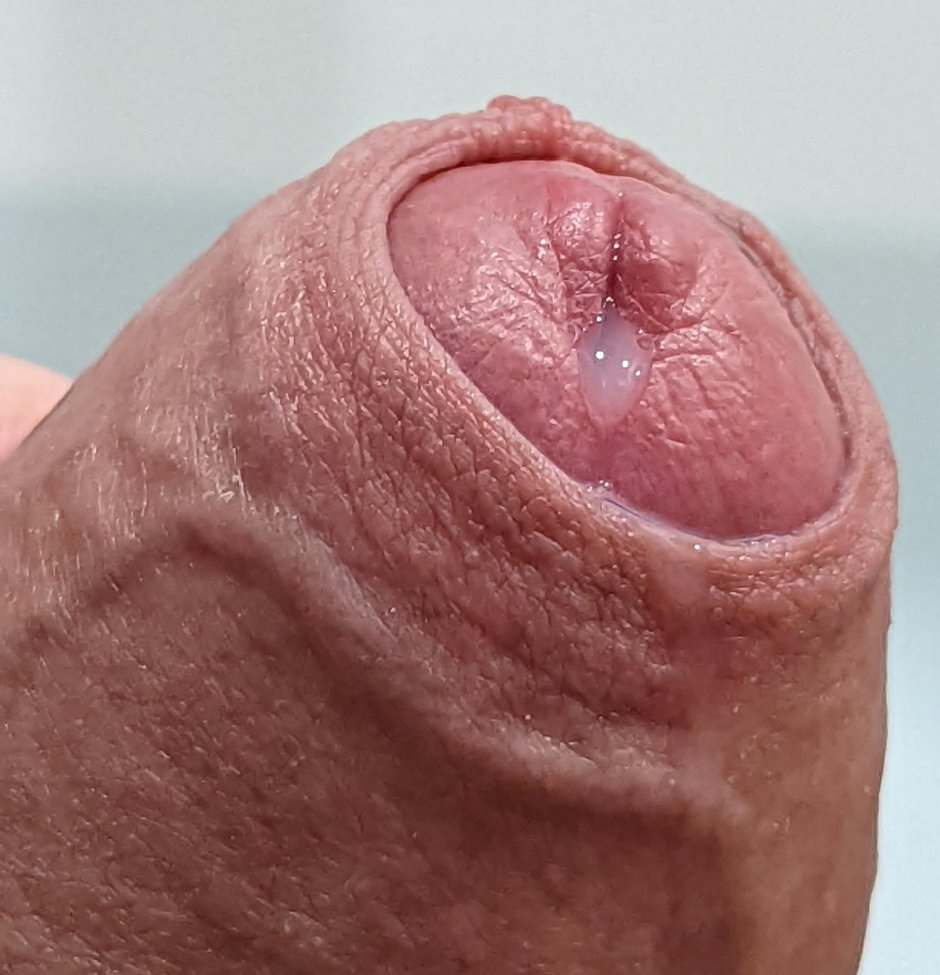 Большая залупа крупным планом