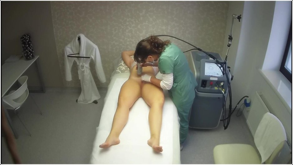 Лазерная депиляция