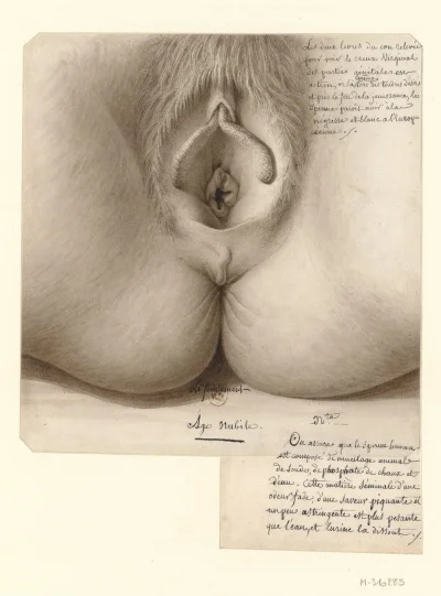 Картина вагина