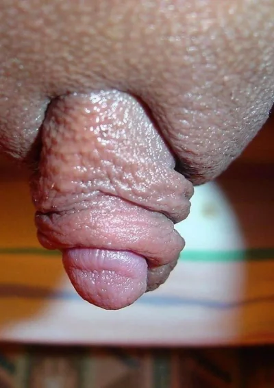 Самый большой клитор в мире