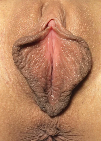 Огромные малые половые губы