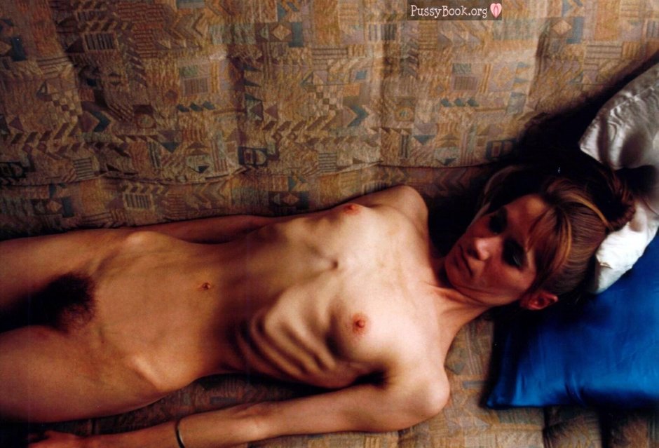 Голые женщины дистрофики