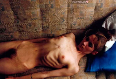 Голые женщины дистрофики