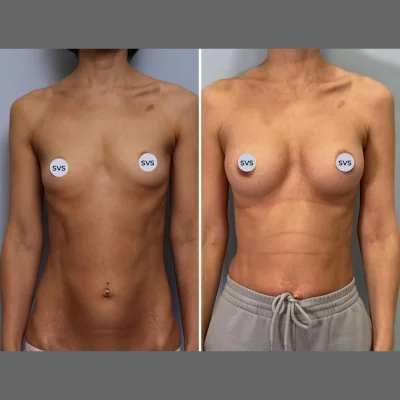 Идеальная грудь