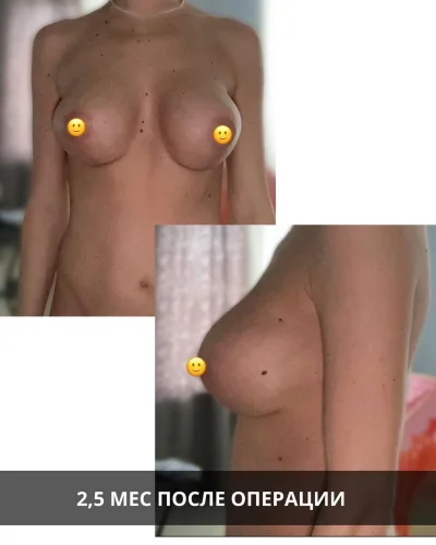 Как выглядят открытые сиськи