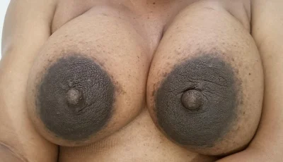 Темные ореолы при беременности