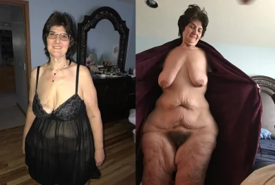 Женщина с одной грудью