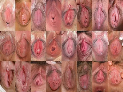 Женская вагина виды