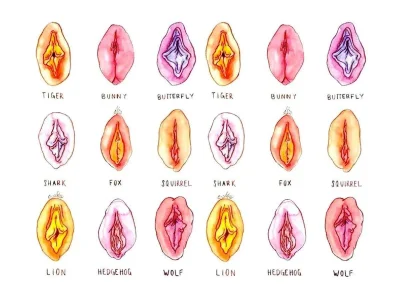Разновидности влагалища рисунки