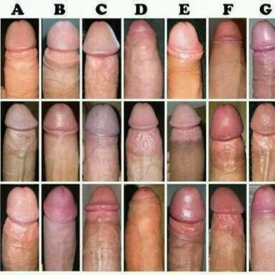 Различные формы полового члена