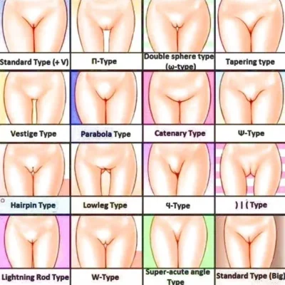 Формы женских влагалищ с названиями