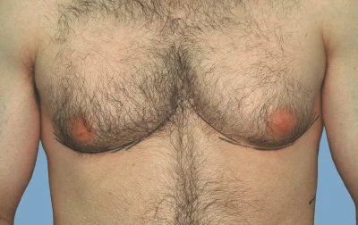 Мужская грудь