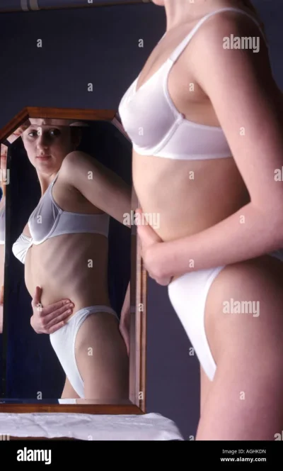 Дисморфофобия анорексия