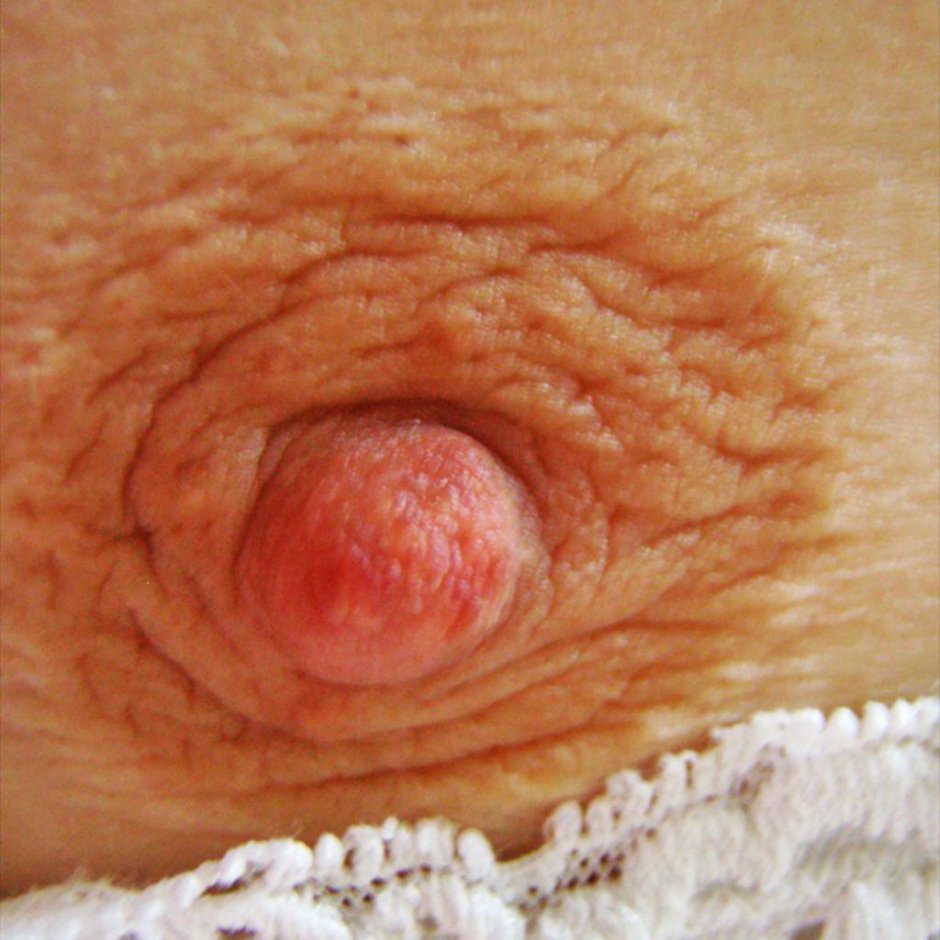 Женские соски