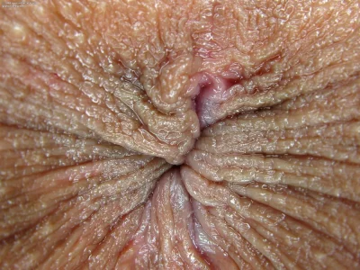 Женский анус крупным планом